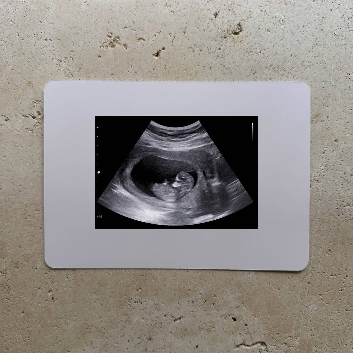 Baby on the Way Ultrasound Card
