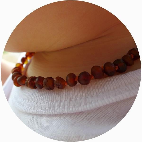 Cognac Raw Baltic Amber Necklace